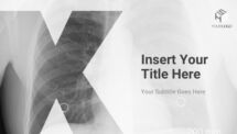 ABC Free PowerPoint Template - Letter X